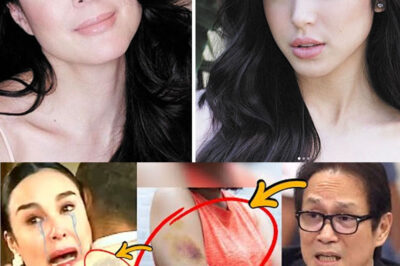 🔥GRETCHEN BARRETTO, NAGKAROON NG MARAMING PASA SA BRASO DAHIL KAY ATONG ANG!🔴(DG)