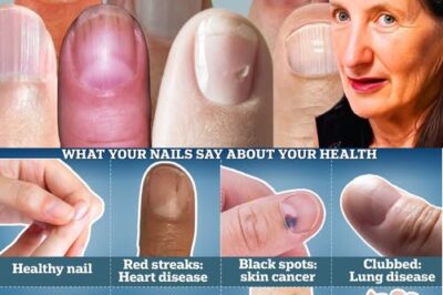 9 Things Your Nails Can Tell You About Your Health