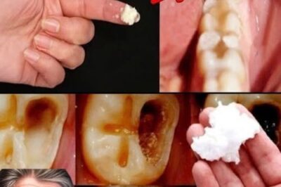 How to Naturally Repair a Cavity and Strengthen Your Teeth